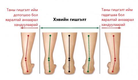 Таны хөл ДОТОГШОО эсвэл ГАДАГШАА гишгэдэг үү?